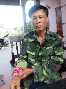 Ông Lê Hải Liên bị thương ở tay trong khi truy bắt tên cướp